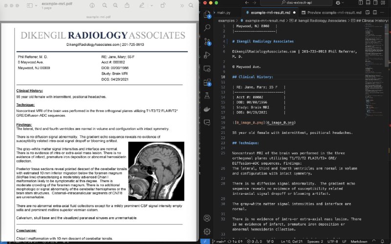 #GitHub #OCR #API pdf-extract-api - 高精度文档解析和提取 API▎项目功能：文档解析和提取▎项目介绍：一个文档解析和提取 API，支持将 PDF 或图片文件转换为结构化的 JSON 或 Markdown 格式